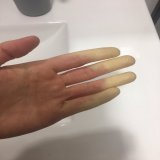 Preg&uacute;ntenle a mi Raynaud si hace fr&iacute;o #enfermedadesraras #lupus #saf