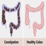 Colon cleansing is the most powerful yet ignored health intervention.  It fixes chronic fatigue, skin problems, and weak immunity.  I've tested this myself, and it does wonders.  Here's how to perform a colon cleanse the right way: