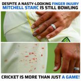Mitchell Starc is a true warrior   #MitchellStarc #AUSvsSA #CricTracker