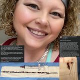 Amanda Cloud received the Moderna Vaccine    She suffered large blood clots, a pulmonary embolism, and the right side of her heart is no failing.   The doctors claim they have &ldquo;no idea&rdquo; Why this is happening.   #diedsuddenly