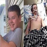tiktok benadryl challenge death A 13-year-old died in Ohio after participating in a Benadryl TikTok 'challenge' Jacob was on a ventilator for almost a week before he died, according to CNN affiliate WSYX. #TikTok #BenadrylChallenge #ventilator