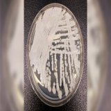 &ldquo;individuals who have been hospitalized in healthcare facilities for long periods of time,especially those who have breathing tubes,feeding tubes,and central venous catheters going into their bodies,appear to be at the highest risk of getting C