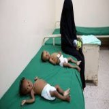 #Yemen Too many victims to count