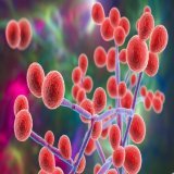 Cases of Candida auris Fungal Infection Dramatically Increase in U.S.  Cases and transmission of highly contagious fungal infections see dramatic increase between 2019 and 2021. Learn why: