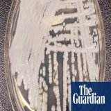 Candida auris: deadly fungal infections spreading across US at &lsquo;worrisome&rsquo; rate