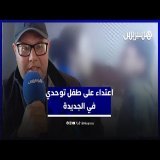 والد طفل من ذوي الاحتياجات الخاصة يوضح حيثيات فيديو الاعتداء عليه من طرف مساعدة في تقويم النطق