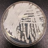 Drug-resistant Candida auris spread &lsquo;worrisome&rsquo; say epidemiologists