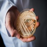 Reports of patients with the drug-resistant fungal infection Candida auris have accelerated in recent years.