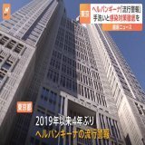 ヘルパンギーナ、とうとう『警報レベル』になりました。  本当に多いです。  これにCOVID、RS、溶連菌、手足口病まで感染拡大して、小児医療は危機的です。  どうか感染対策の強化をお願いします。  子どもを中心に流行する感染症「ヘルパンギーナ」　東京都で流行警報