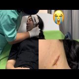 منويتهاش فعائلة راجلي والله \ud83e\udd7a مشيت لسبيطار شفت وجهي بعد العملية تصدمت \ud83d\ude2d