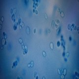Candida auris, a drug-resistant fungus that health officials hoped to contain is now in more than half the 50 states,