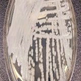 Candida auris fungus spreading in U.S. hospitals - CDC