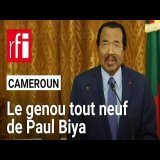 Cameroun : le genou tout neuf de Paul Biya (revue de presse) • RFI
