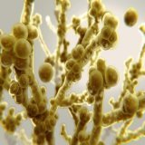 CDC WARNING  The CDC is warning that an antimicrobial-resistant form of Candida auris poses an urgent threat and is spreading rapidly in U.S. healthcare facilities. The fungus can cause severe infections with high death rates.  #TruBlue #wtpBLUE