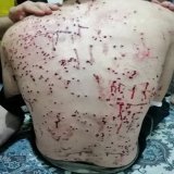 Ein 15 j&auml;hriger aus Mahabad, eine kurdische Stadt im #Iran. Die sog. Sicherheitskr&auml;fte der Islamischen Republik Iran verletzen/ durchl&ouml;chern unter anderem mit Schrotkugeln die Protestierenden, die sich gegen das Regime stellen. Quelle: