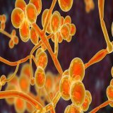 The fungus, Candida auris, was identified in Asia in 2009 but was first reported in the US in 2016. The number of infections in the country has risen by 95% between 2020 and 2021