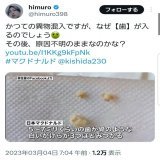 #マクドナルド値上げ マクド値上げするみたいですね。 まだ食べてる方は、これを機に食べるの止めた方がいいですよ。  \u25cf14年経っても腐らない \u25cf歯の混入  まともな食べ物だとは思えません。 添加物を溜め込んだ体でいると7月末、大変な苦痛が襲うそうです。