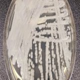 As noted repeatedly by minimizers, if COVID were adversely affecting immune systems, we'd be seeing reports of rising infections with other viruses, bacteria, and fungi...