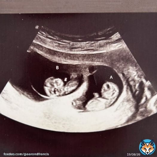 I'm incredibly excited to share that my wife and I are expecting twins in the fall!   You may be thinking... but Aaron, you already have twins.  Yes. Yes, we do.   We're going to have another set of twins, somehow. Four kids under three years old.   d.   Send help!