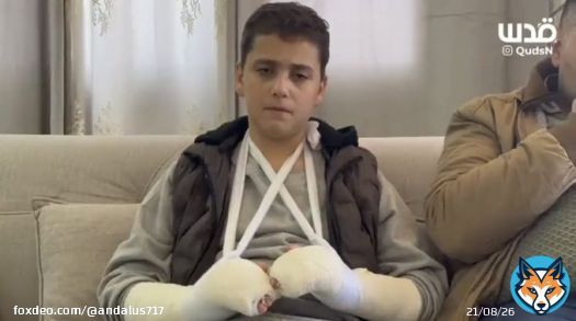 He left from Israel prison with broken arms and fingers, with a broken soul. She left Gaza with a pet. Do you guys understand the difference