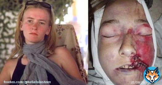 --------------RIP RACHEL CORRIE-----------  #FreePalestine  #IsraeliTerrorism  #FreePalestine  #IsraeliCrimes   #عرين_الأسود  #IsraeliTerrorism  #BDS   #نابلس  #فلسطين  #فلسطين_قضية_الشرفاء  #نابلس_تقاوم #الله_أكبر   #IsraeliApartheid  #جيش_فلسطين_الالكتروني