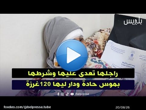 القنيطرة: راجلها تعدى عليها وشرطها بموس حادة ودار ليها 120غرزة