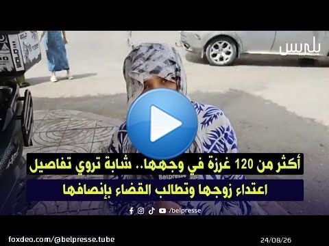 القنيطرة: أكثر من 120 غـ/رزة في وجهها.. شابة تروي تفاصيل اعـ/تداء زوجها وتطالب القضاء بإنصافها