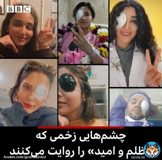 These are 6 brave Iranian protesters who lost one of their eyes due to a bullet hit by the repression forces during the #iranprotest . Their smile shows their resistance against the Iranian regime! #MahsaAmini #IRGCterrorists  @EU_Commission @coe @EUCouncil @Europarl_EN @UN @VP