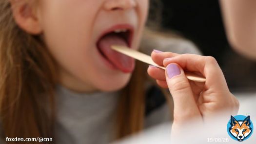After two years of significantly low levels, strep infections in the US have surged again this season, according to a new analysis.