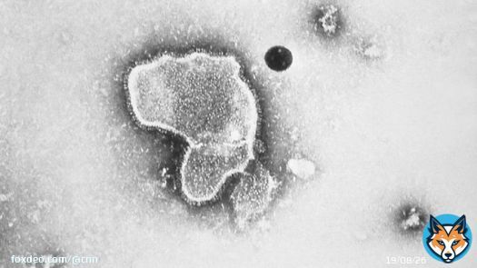 Adults 60 and older will be eligible to get a shot that could protect them from respiratory syncytial virus, or RSV, this fall if the US CDC follows the advice of its independent vaccine advisory committee.