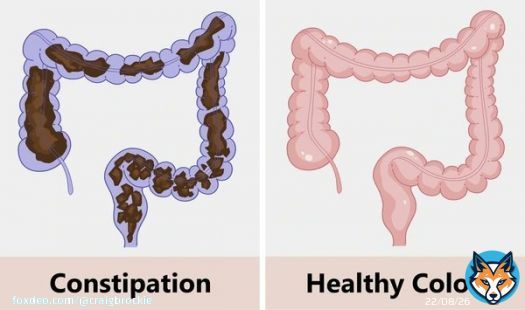 Colon cleansing is the most powerful yet ignored health intervention.  It fixes chronic fatigue, skin problems, and weak immunity.  I've tested this myself, and it does wonders.  Here's how to perform a colon cleanse the right way: