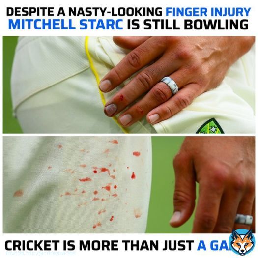 Mitchell Starc is a true warrior   #MitchellStarc #AUSvsSA #CricTracker