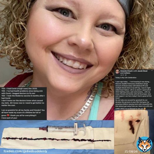 Amanda Cloud received the Moderna Vaccine    She suffered large blood clots, a pulmonary embolism, and the right side of her heart is no failing.   The doctors claim they have &ldquo;no idea&rdquo; Why this is happening.   #diedsuddenly