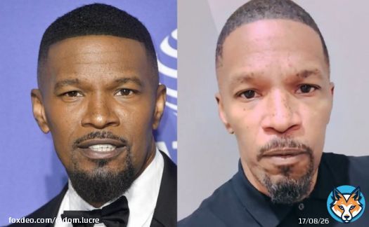 This is literally Jamie Foxx. You won&rsquo;t look the same when you&rsquo;re sick.