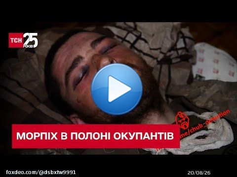 \ud83d\ude2d \ud83d\udc94 Gleb Strizhko, a Ukrainian prisoner of war in Mariupol, has been released. He was captured by a tank at the Ilyich Steel Works, severely wounded, with a fractured pelvis and untreated for 17 days. #Ukraine #Kyiv #UkraineRussRussiaWar  来自 @YouTube