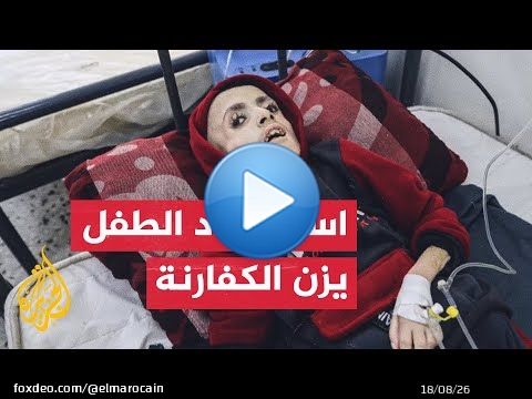 استشهاد الطفل يزن الكفارنة بمستشفى أبو يوسف النجار بسبب سوء التغذية