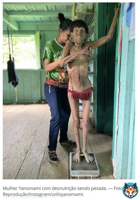 Essas fotos precisam rodar o mundo! O genocidio do povo yanomami n&atilde;o pode ficar impune. Foram 4 anos de neglig&ecirc;ncia completa! Foi assassinato deliberado #BolsonaroPreso