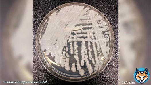 &ldquo;individuals who have been hospitalized in healthcare facilities for long periods of time,especially those who have breathing tubes,feeding tubes,and central venous catheters going into their bodies,appear to be at the highest risk of getting Candida auris