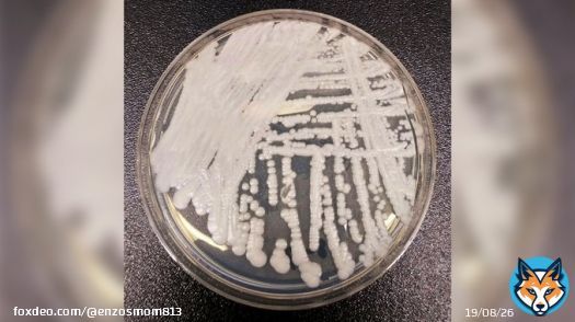&ldquo;individuals who have been hospitalized in healthcare facilities for long periods of time,especially those who have breathing tubes,feeding tubes,and central venous catheters going into their bodies,appear to be at the highest risk of getting Candida auris