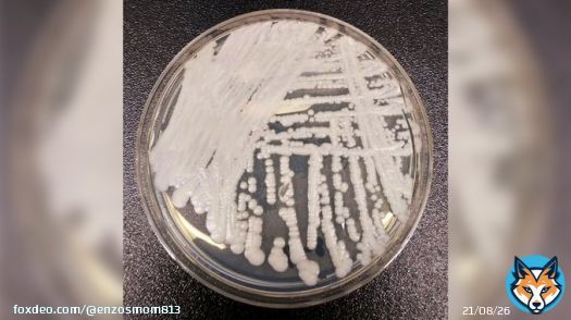 &ldquo;individuals who have been hospitalized in healthcare facilities for long periods of time,especially those who have breathing tubes,feeding tubes,and central venous catheters going into their bodies,appear to be at the highest risk of getting Candida auris