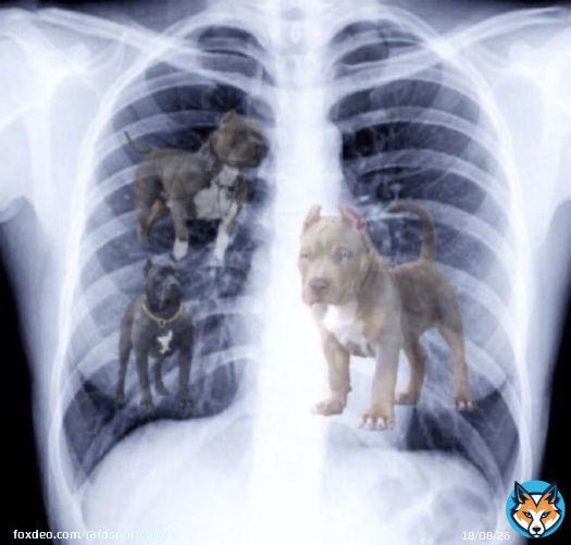 MAX DUGGAN'S X-RAYS JUST DROPPED: