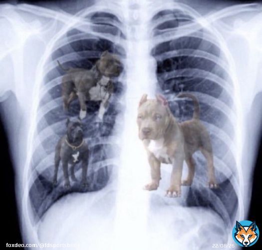 MAX DUGGAN'S X-RAYS JUST DROPPED: