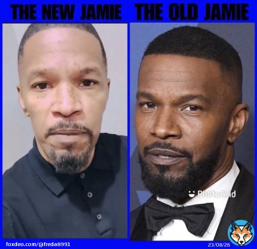 Actor Jamie Foxx speaks after being injured by the convid injection.