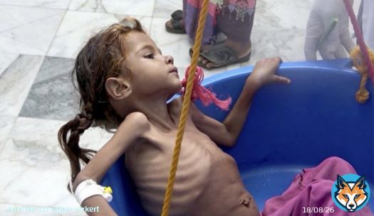 Weighing next to nothing in #Yemen