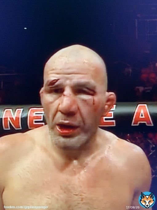 OMG Glover Teixeira is a beast his eyebrows are literally falling off #UFC283 @ufc