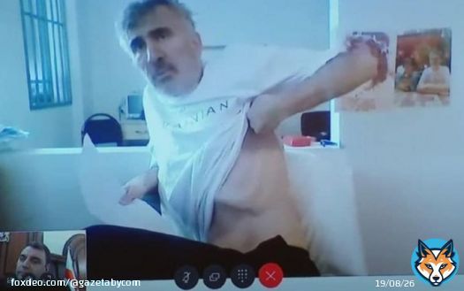 Саакашвили показал последствия пребывания под стражей  Бывший президент Грузии Михаил Саакашвили на судебном заседании по видеосвязи продемонстрировал, в каком ужасном физическом состоянии он находится: