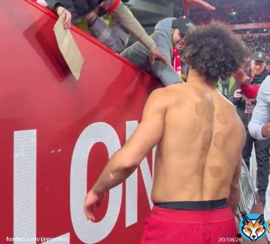 محمد صلاح ظهر في فيديو متدوال يهدي قميصه لأحدي المشجعين وفي ظهره علامات العلاج بالحجامة وصية رسول الله #محمد_صلاح