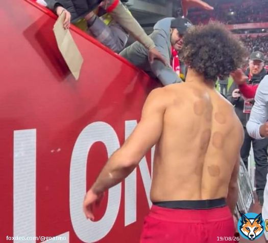 محمد صلاح ظهر في فيديو متدوال يهدي قميصه لأحدي المشجعين وفي ظهره علامات العلاج بالحجامة وصية رسول الله #محمد_صلاح