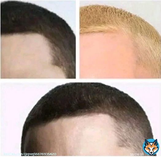 Is it weird that we all know who this is without seeing his face