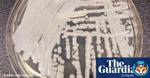 Candida auris: deadly fungal infections spreading across US at &lsquo;worrisome&rsquo; rate